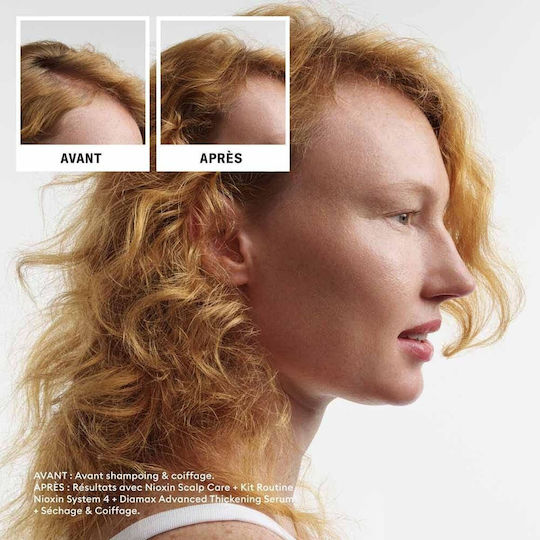 Nioxin System 4 Σετ Περιποίησης Μαλλιών με Σαμπουάν & Conditioner 3τμχ