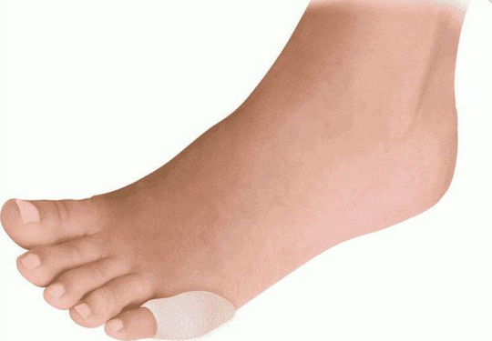 Alfacare Herbi Feet Protective Gel Small Toe 1 Piece