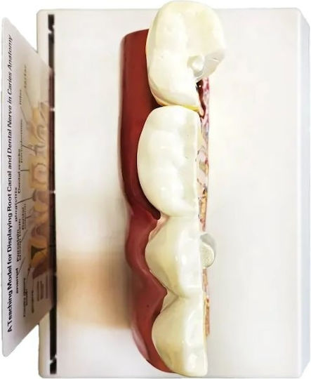 Model Anatomical De Dinți Matriță Model Oral Realist Model Dentar Cabinet Stomatologic Demonstrații Dentare Școală Dentară Bază Dimensiune 16.1 X 12.5 Cm Matriță 13.8 X 8.5 Cm Material Rășină Multicolor