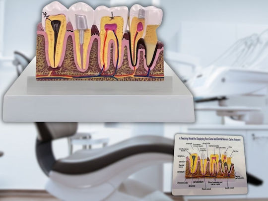 Model Anatomical De Dinți Matriță Model Oral Realist Model Dentar Cabinet Stomatologic Demonstrații Dentare Școală Dentară Bază Dimensiune 16.1 X 12.5 Cm Matriță 13.8 X 8.5 Cm Material Rășină Multicolor