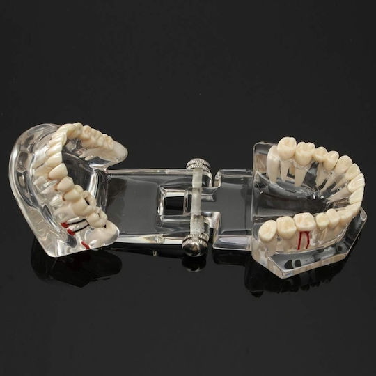 Model Dentar Anatomie Maxilară Dinți