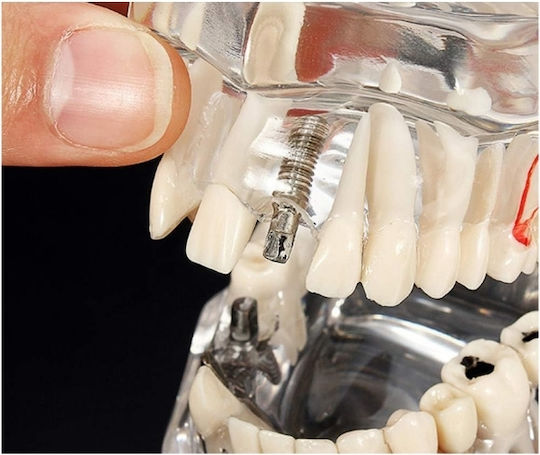 Model Dentar Anatomie Maxilară Dinți