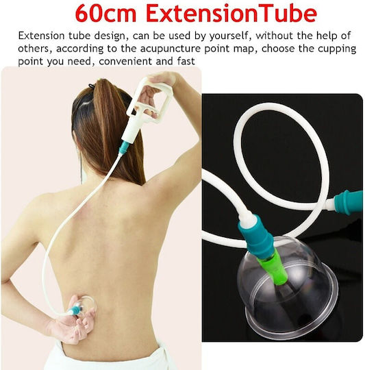 Set of 18 Traditional Therapy Suction Cups