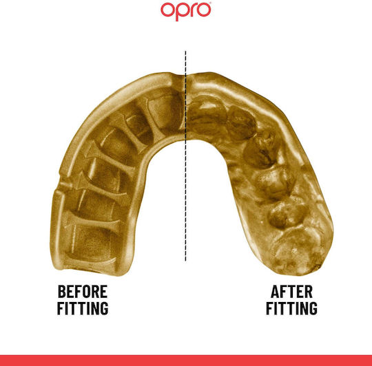Μασέλα Opro Gold Edition V2 Self Fit Black Gold