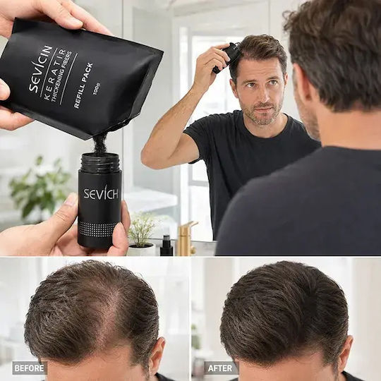 Sevich Hair Thinning Coverage Fibers with Keratin Building 100gr
