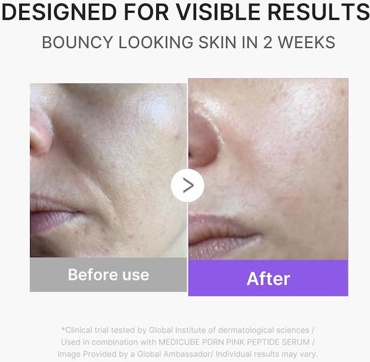 Medicube Age-r Booster Face Care Device