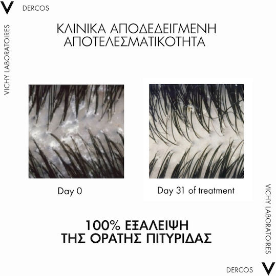 Vichy Dercos Anti Dandruff DS Σαμπουάν για Ευαίσθητο Τριχωτό κατά της Πιτυρίδας & της Ξηροδερμίας για Ξηρά Μαλλιά Μαλλιά 390ml