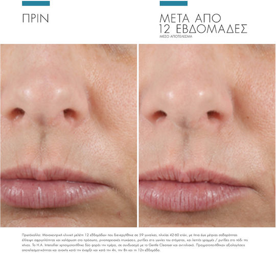 SkinCeuticals H.A. Intensifier Αντιγηραντικό Serum Προσώπου με Υαλουρονικό Οξύ 30ml
