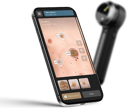 Δερματοσκόπιο Dermlite Dl5 Plus