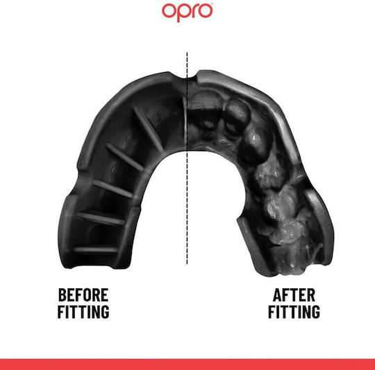 Proteza Dentară Opro Silver Edition V2 Self Fit Alb Negru