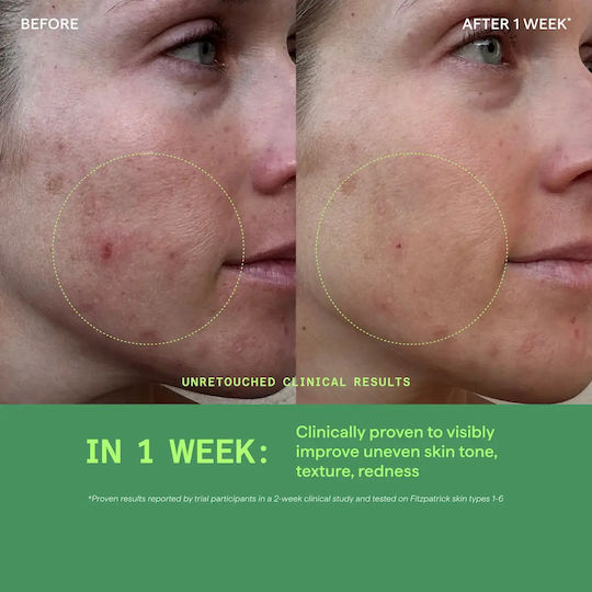 Murad Moisturizing and Regulating Face Day Cream for Blemishes and Acne with Niacinamide 50ml