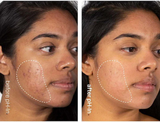 Set rutină de îngrijire pentru piele sensibilă predispusă la acnee în 3 pași Ph-in Healthy Skin System Indeed Labs 3 articole