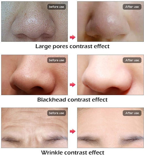 Face Phototherapy Mask HYH-07088