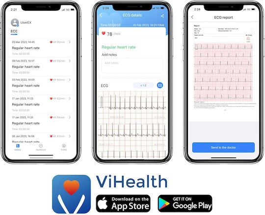 Holter Rhythmus mit Bildschirm