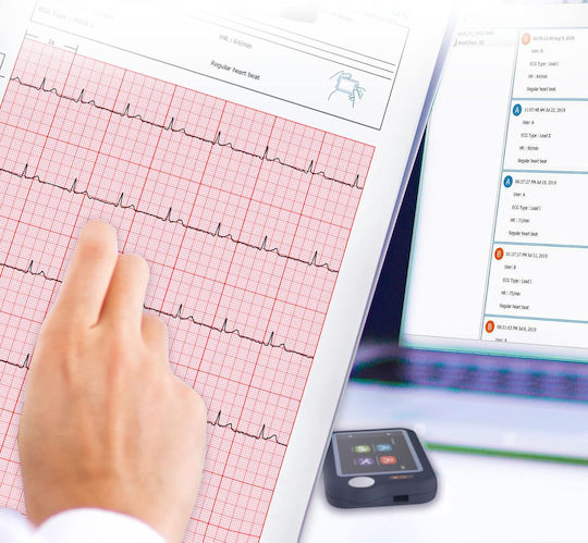 Holter Rhythmus mit Bildschirm