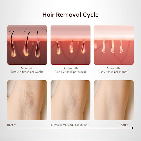 Lubex Epilator IPL