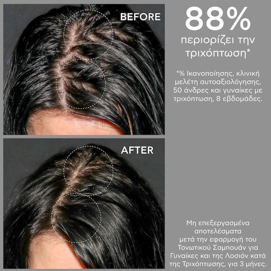 Apivita Tonic Shampoos against Hair Loss for All Hair Types 250ml