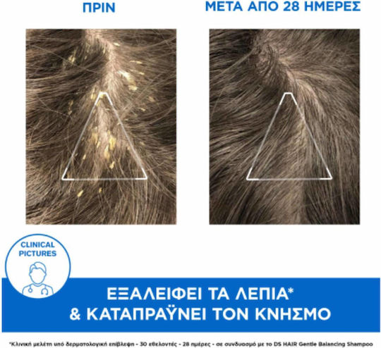 Uriage DS Hair Kerato-reducing Treatment Σαμπουάν κατά της Πιτυρίδας για Όλους τους Τύπους Μαλλιών 150ml