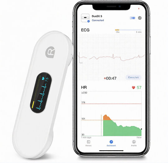 Φορητός Ηλεκτροκαρδιογράφος Bluetooth Viatom