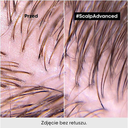 L'Oréal Professionnel Șampon Avansat pentru Păr Gras 500ml