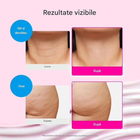 Eqqualberry Nad+ Cremă de Față Anti-îmbătrânire și Reconstrucție 24 Ore împotriva Roșeții cu Colagen și Niacinamidă 50ml
