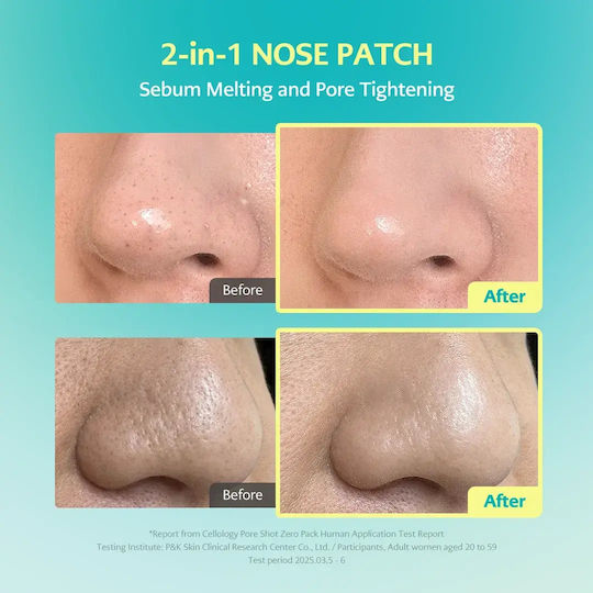 Jumiso Overnight Zero Pore Лентички за нос 10 бр
