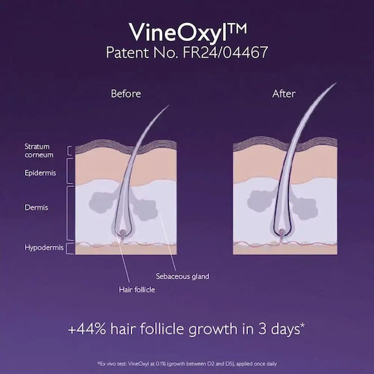 Anti-Hair Loss Serum Against Hair Loss & Volume Boosting 50ml