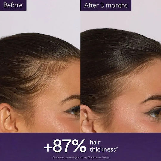 Anti-Hair Loss Serum Against Hair Loss & Volume Boosting 50ml