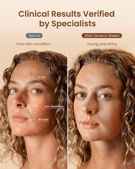 Renpho Renpho Artemis Blush Gesichtspflegegerät Maske für Phototherapie des Gesichts
