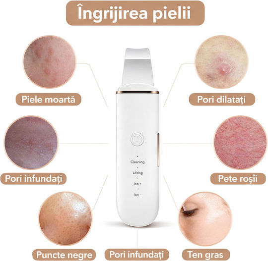 Dispozitiv Ultrasonic Pentru Curățare Facială Funcție Hidratare Peeling 4 Moduri Reîncărcabil Usb Alb