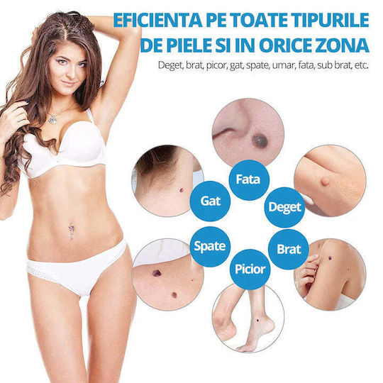 Littledomi Skin Tag Removal Device Kit Face Neck Body 2-8 Mm