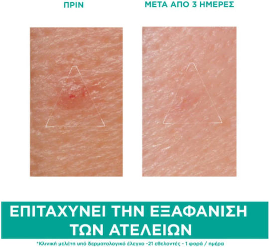 Uriage Hyseac Sos Cream Face 15gr