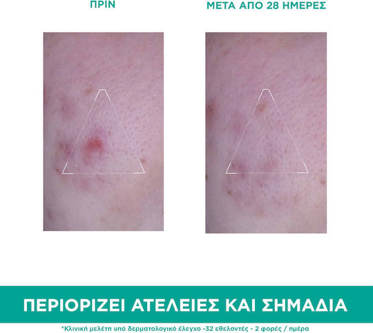 Uriage Hyseac Лека Хидратираща Крем за Лице Дневен с Витамин Е 40ml