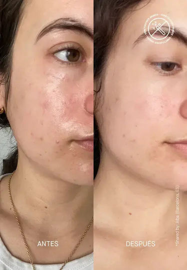 Transparent Lab Cream Face with Centella Asiatica 50ml