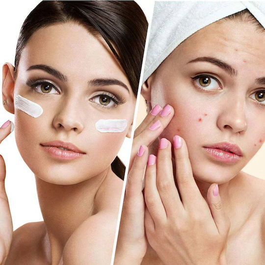 Biovene Blemish Control Lotion Face 50ml