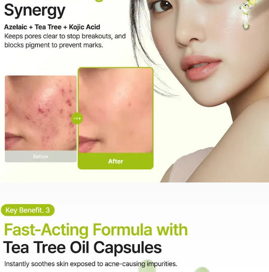 Azelaic Acid 10 Kojic Tea Tree Serum Face for Whitening & Acne 30ml