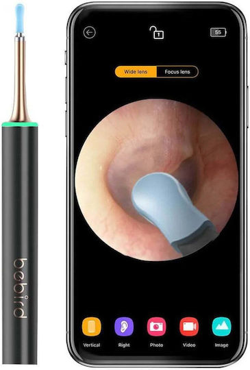 Bebird Otoscope with Digital Recording