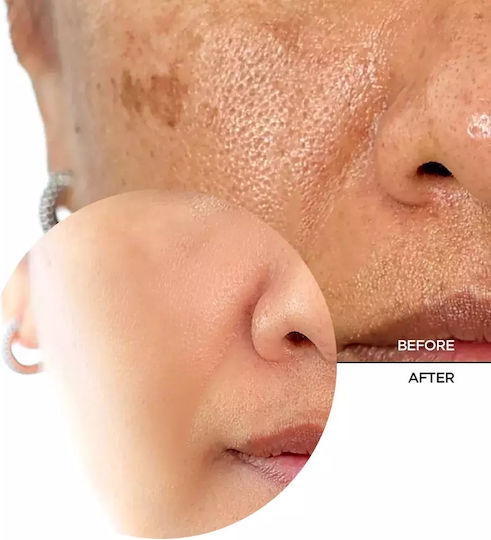 Revox Biotic Resurfacing Activator Face Serum with Panthenol 30ml
