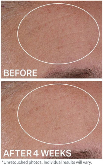 Anti-Aging Serum Gesicht mit Hyaluronsäure 30ml