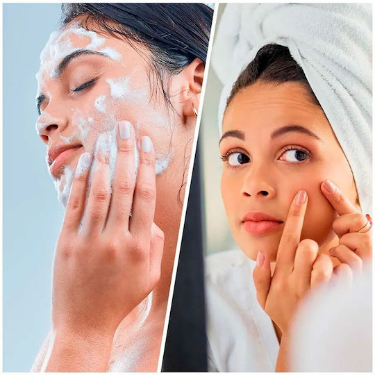 Biovene Salicylic Super Cleanser Cremă De Curățare Facială 200ml
