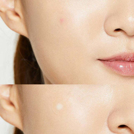 Cosrx Pimple patches 26τμχ