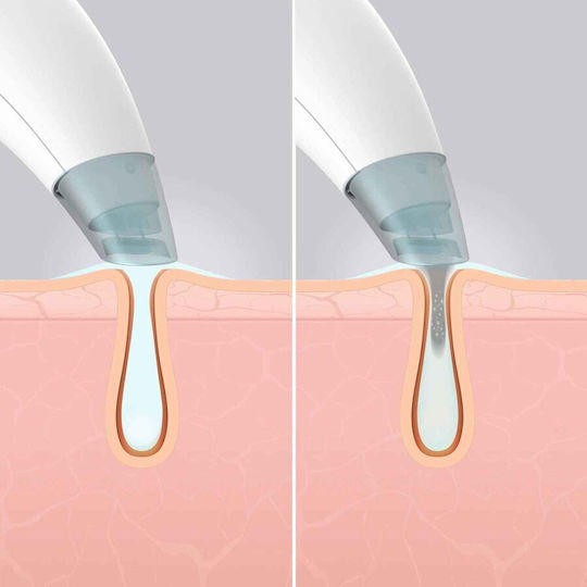 Homedics Aparat Facial cu Aspirare T-MLX53812