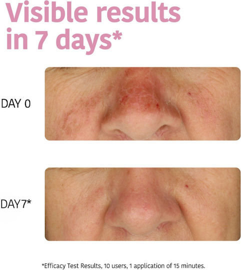 Aloe Beruhigende & Hydratisierende Stoffmaske 20ml