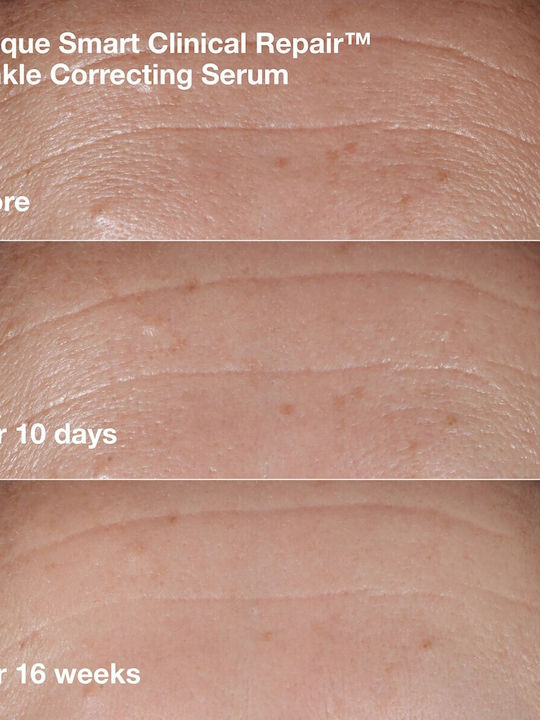 Clinique Smart Clinical Repair Travel Set for Anti-Aging & Firming 4 Pieces