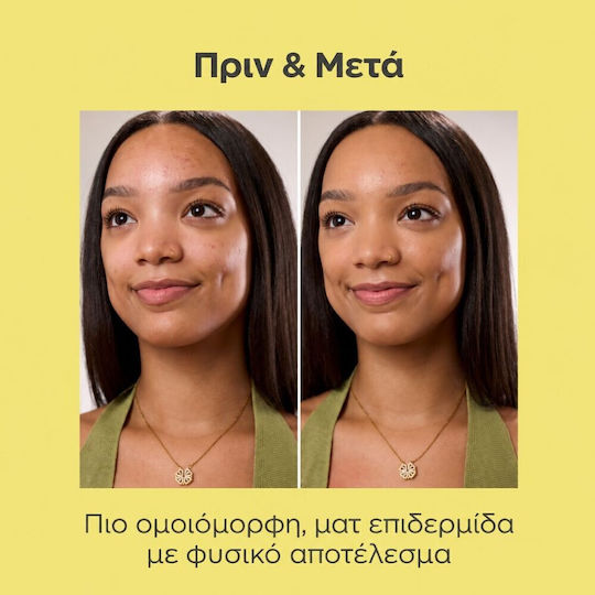 Acniben CC Ενυδατική Κρέμα Προσώπου Ημέρας με SPF30 κατά των Ατελειών 40ml