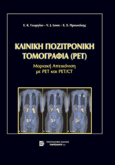 Κλινική ποζιτρονική τομογραφία Κλινική ποζιτρονική τομογραφία