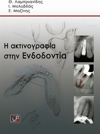 Η ακτινογραφία στην ενδοδοντία