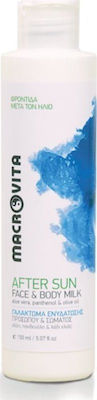 Macrovita Face & Body After Sun Emulsion for Face and Body 150ml