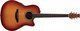 Ovation Ηλεκτροακουστική Κιθάρα Applause AB24II Mid Cutaway Cutaway Burst