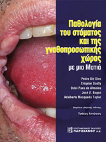 Παθολογία του στόματος και της γναθοπροσωπικής χώρας με μια ματιά Παθολογία του στόματος και της γναθοπροσωπικής χώρας με μια ματιά